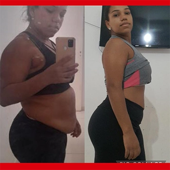 Antes e depois de aluna do método